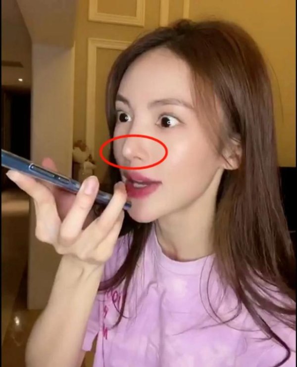 淘配网 有种嘴硬叫“我没整容”！大饼脸变小V脸，这些明星真当观众瞎？
